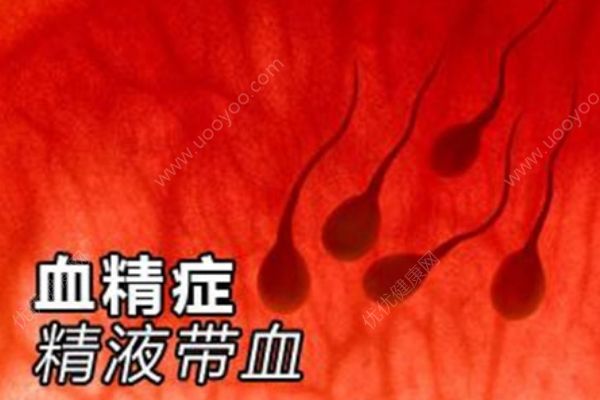 男人得了血精癥怎么辦？推薦四大血精癥的食療方！(1)