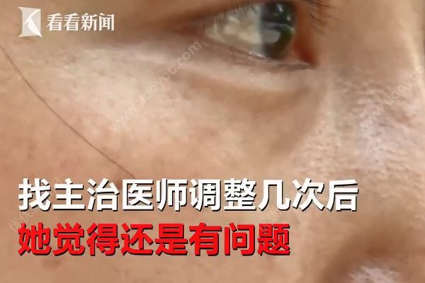 女子整容后一下子老了十多歲，醫(yī)院稱自己資質(zhì)合法(4)