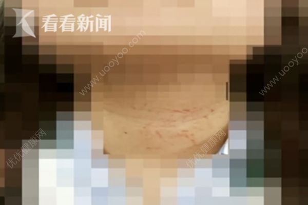 男子被心儀女主播嘲諷后不爽，欲掐死對(duì)方后自殺(3)