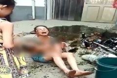 電動(dòng)車撞翻早餐攤油鍋，1歲半男娃被熱油從頭澆下[多圖]