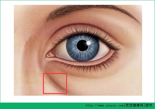 臥蠶和黑眼圈有什么區(qū)別？臥蠶和眼袋有什么區(qū)別？(4)