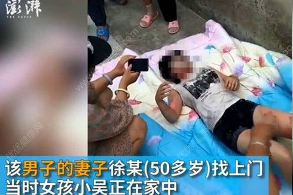 17歲少女在家被人用開水灌喉，嫌犯疑為母親