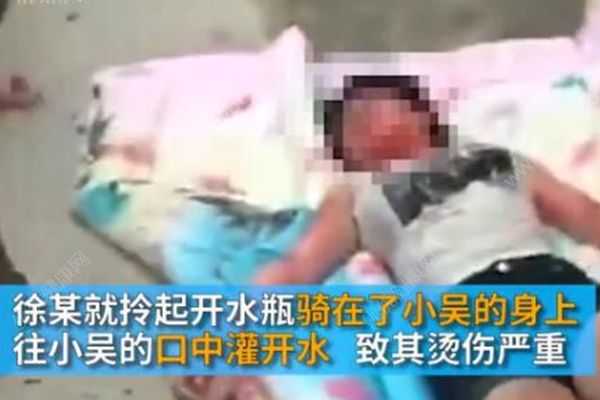 17歲少女在家被人用開水灌喉，嫌犯疑為母親