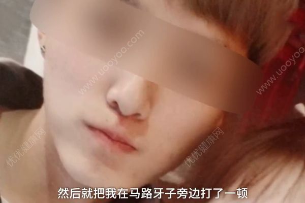 小伙沒給陌生人微信被追打！女友說因為他長得帥呀！(2)