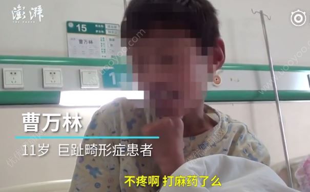 媒體傳11歲大腳娃手術(shù)為省錢不打二百元麻藥，被批真外行(3)