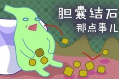 哪些人最容易得膽結(jié)石？膽結(jié)石有哪些明顯特征？[多圖]