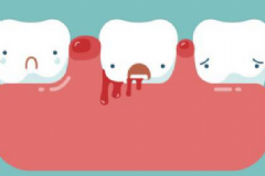 牙齦出血的治療方法有哪些？牙齦出血的注意事項(xiàng)有哪些？[圖]