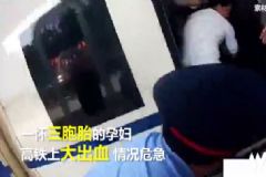 三胞胎孕婦火車上大出血，孕婦大出血該怎么辦？[多圖]