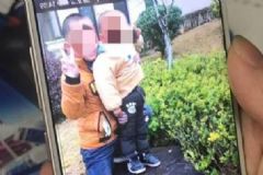 10歲男孩沖進(jìn)火場救4歲弟弟全身被燒傷，被燒傷后怎么辦？[多圖]