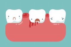 牙齦出血的原因有什么？牙齦出血怎么調理？[圖]