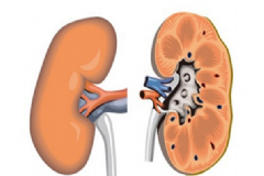 腎盂腎炎能治好嗎？腎盂腎炎的早期癥狀[圖]