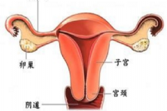 附件炎如何根治？附件炎是怎么引起的？[圖]