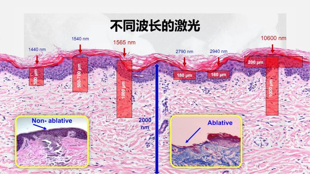 皮膚微創(chuàng)整形術(shù)后注意事項(xiàng)有哪些？廣州伊站醫(yī)療美容中心好嗎