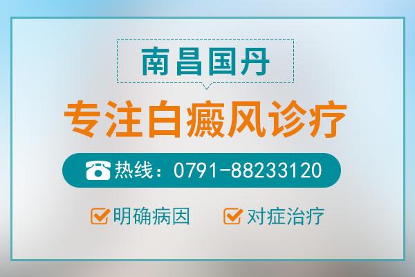 南昌國丹醫(yī)院怎么樣？治療白癜風(fēng)正常大概花多少錢？