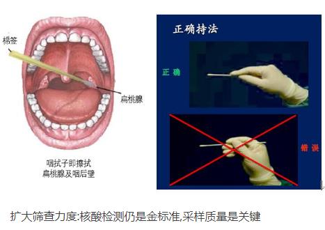 核酸檢測(cè)新冠病毒的常用手段：口腔拭子、鼻腔拭子檢測(cè)圖解