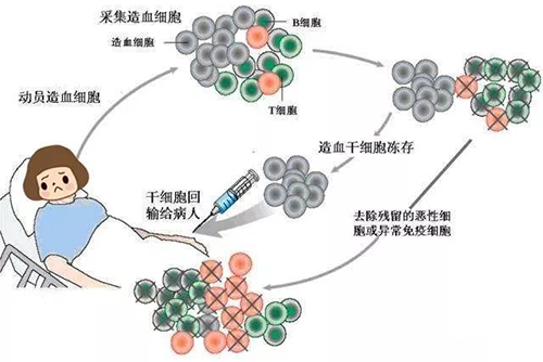 濟南血液病醫(yī)院：治療淋巴瘤自體造血干細(xì)胞移植效果咋樣？