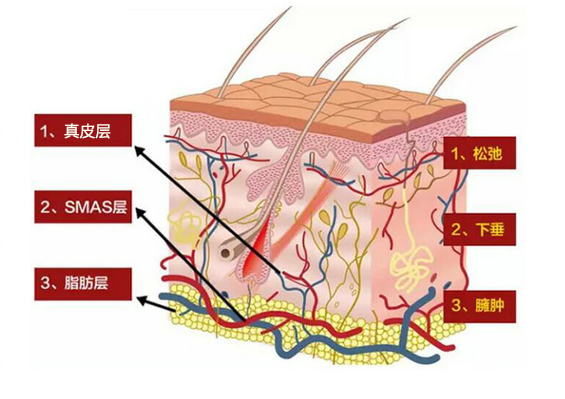 什么是赫本線？聯(lián)合麗格向淑英抗衰新理念：45°赫本線緊致術(shù)