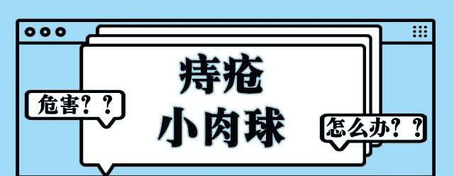 天津歐亞肛腸醫(yī)院解答：外痔瘡肉球摸著別扭，發(fā)作起來(lái)疼痛，怎么消除？