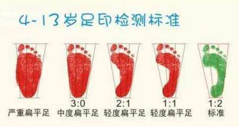 扁平足能跑步嗎？扁平足跑步有什么危害？