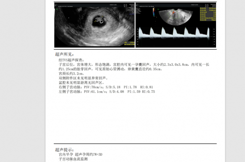 年近不惑苦求二胎，陳怡主任幫她圓夢(mèng)升級(jí)