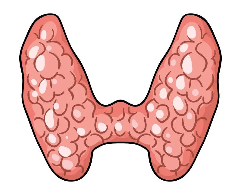 當心！成都民生耳鼻喉醫(yī)院：身體有這幾種表現(xiàn)，說明你的甲狀腺出了問題！