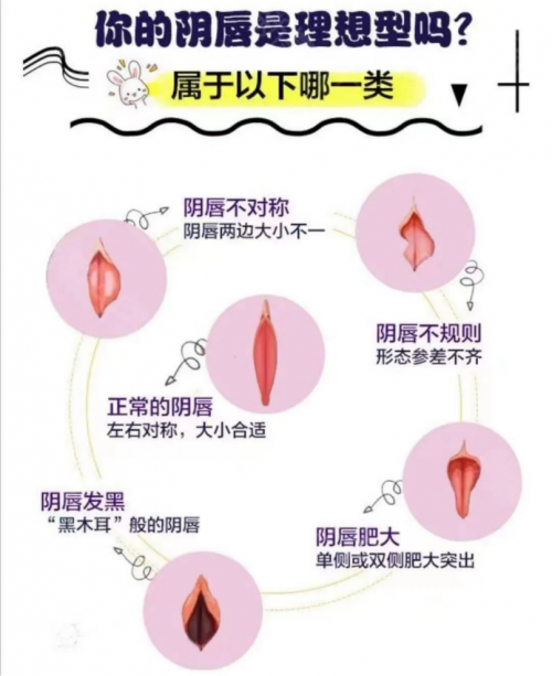 昆明做陰唇整形會留疤嗎？多久能恢復呢？