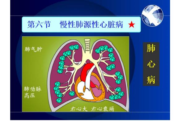 冠心病是心臟病嗎？什么是肺源性心臟?。? data-resizeimgcut=