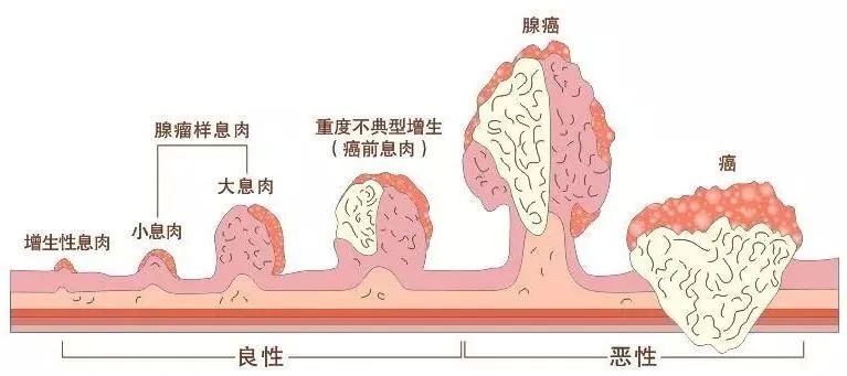  揚(yáng)州妙手醫(yī)院睡眠式無痛胃腸鏡檢查，不僅準(zhǔn)確，而且“快速”