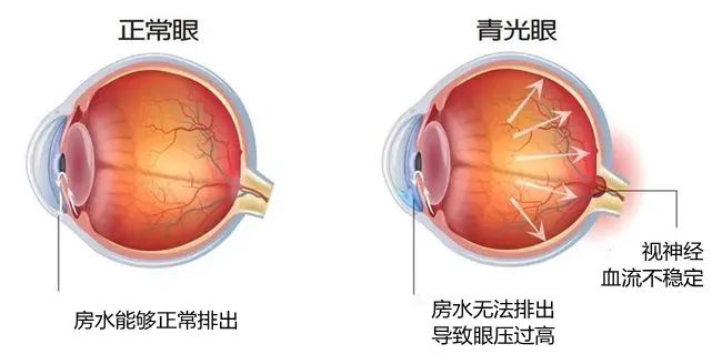 株洲愛爾代敏丨為“獨(dú)眼”女子守住最后一絲光明！