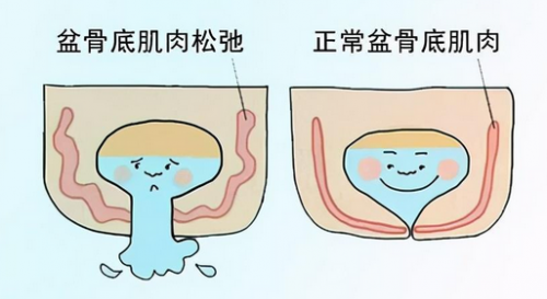 在昆明關(guān)于陰道松弛，你一定要知道的這些問(wèn)題