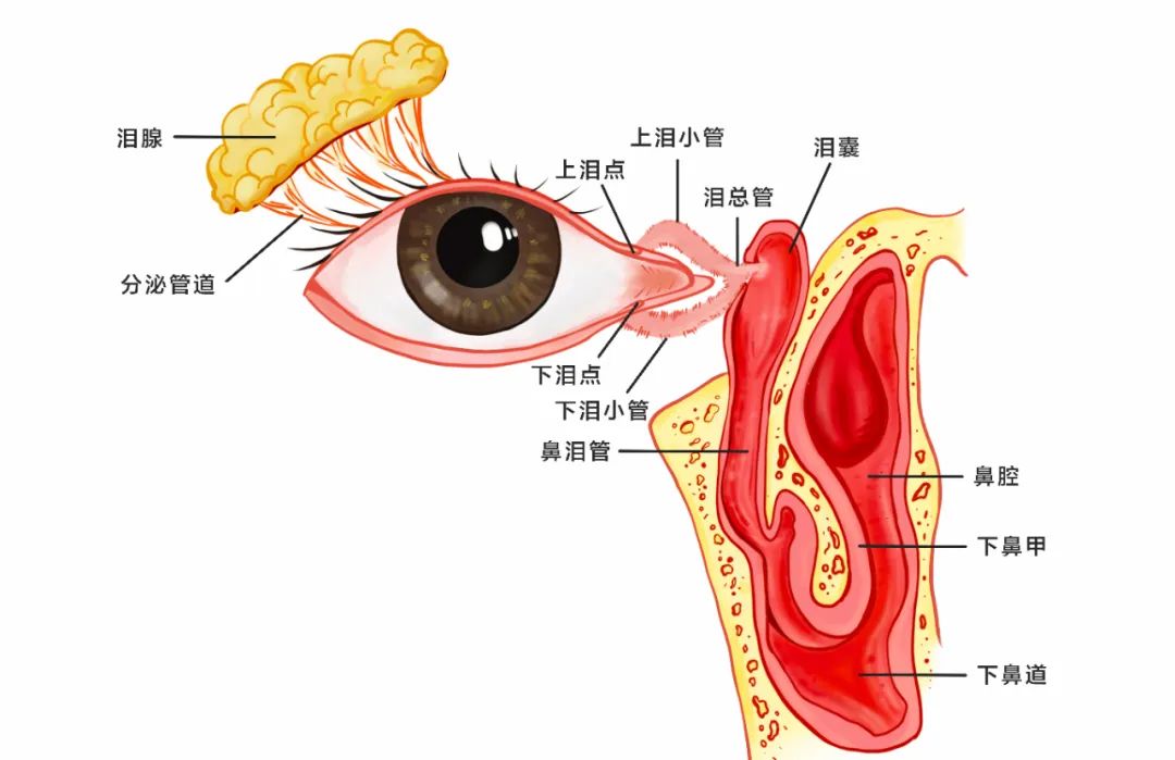 合肥愛(ài)爾眼科：女孩流淚8年？！原來(lái)是淚道堵塞！