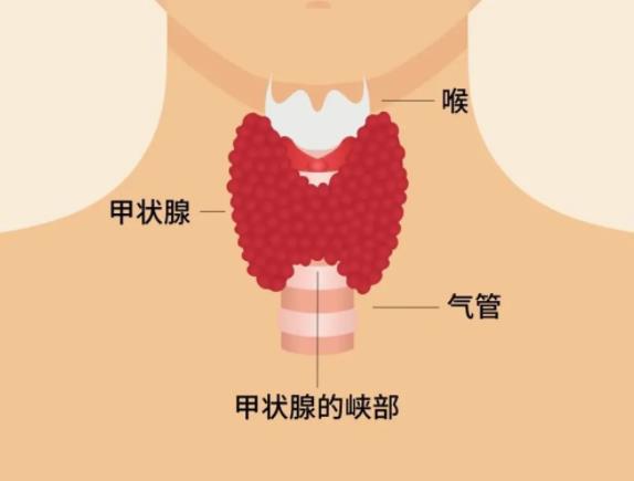 甲狀腺結節(jié)有什么癥狀 甲狀腺結節(jié)伴鈣化什么意思