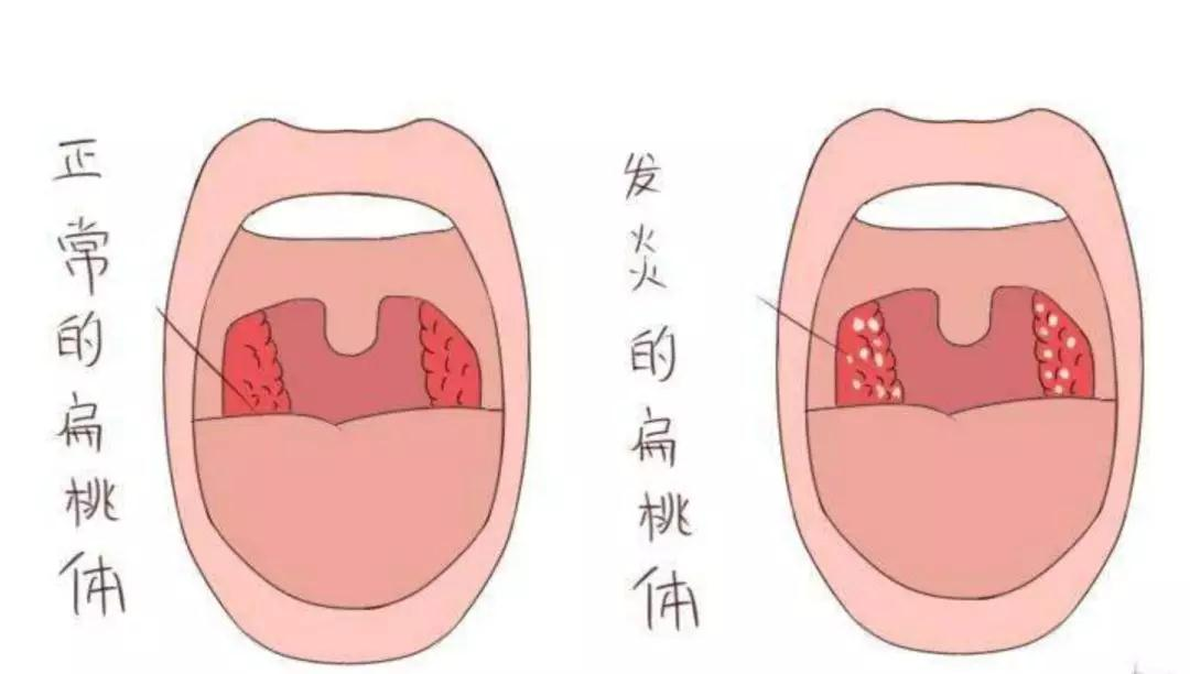 成都民生耳鼻喉醫(yī)院一大波優(yōu)惠活動(dòng)來(lái)襲！耳鼻喉內(nèi)窺鏡檢查免費(fèi)，預(yù)約從速！