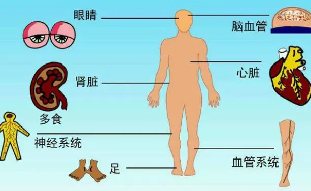 糖尿病會造成飛蚊癥嗎 糖尿病有哪些癥狀