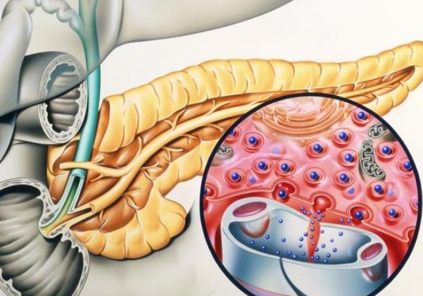 胰腺癌到底有多可怕？ 哪些人容易得胰腺癌？