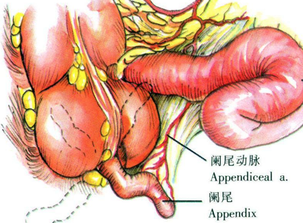 闌尾炎要做手術嗎 闌尾炎手術并發(fā)癥有哪些