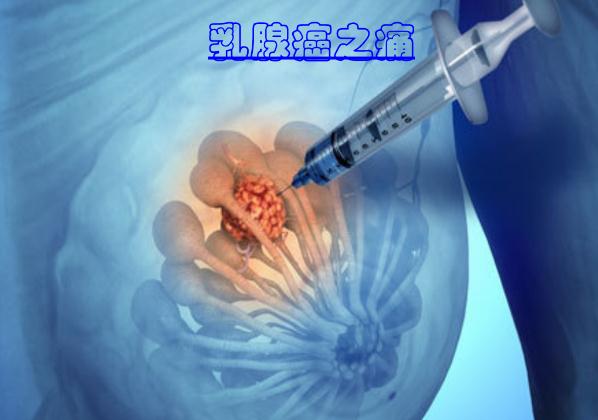 這些食物可以預(yù)防乳腺癌 ？乳腺癌手術(shù)后多久化療？