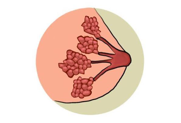 乳腺結(jié)節(jié)可以治好嗎 將切除腫塊組織病理檢查根治