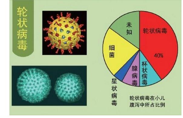 輪狀病毒發(fā)病有哪些特點(diǎn)？感染輪狀病毒后可以吃什么？