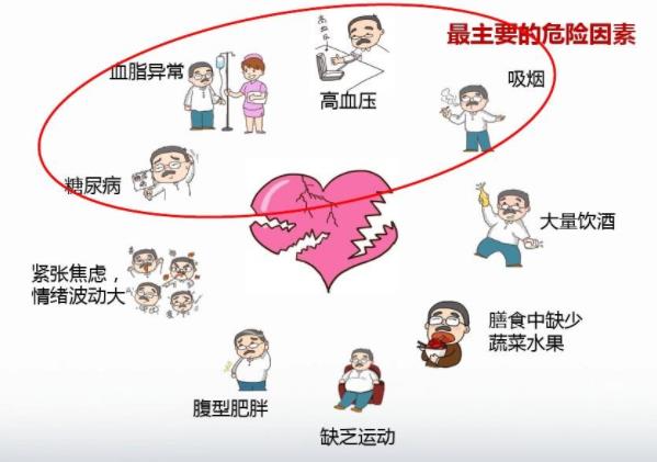 如何診斷冠心病 冠心病好了還會(huì)復(fù)發(fā)嗎