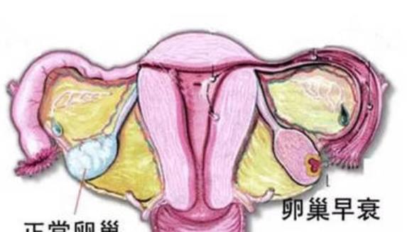 卵巢早衰有哪些癥狀 卵巢早衰有哪些前兆