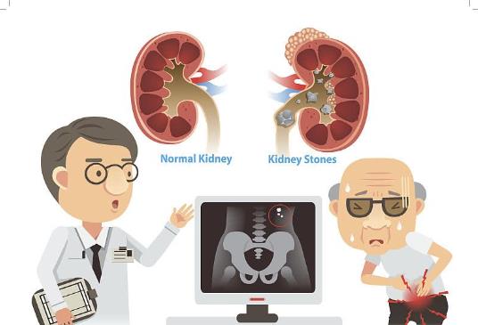 腎結石可以吃辣椒嗎 腎結石豆類可以吃嗎