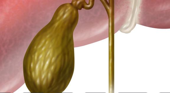 膽結石怎么治療 急性膽囊炎膽結石必須手術嗎