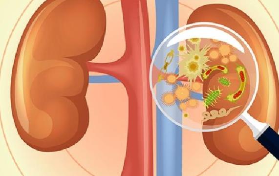 腎結(jié)石有哪些癥狀 腎結(jié)石在腎里會痛嗎