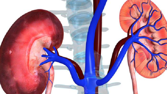 狼瘡性腎炎會死嗎 狼瘡性腎炎會傳染嗎