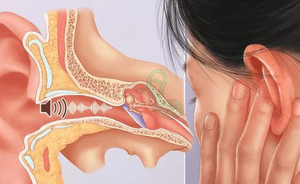 中藥治療耳鳴嗎 中藥治療耳鳴多久能好