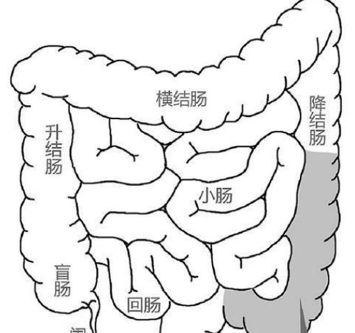 結(jié)腸炎早期有哪些癥狀 腹痛便血腸阻塞穿孔