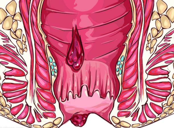 馬應龍痔瘡膏去黑眼圈嗎 馬應龍痔瘡膏價格多少