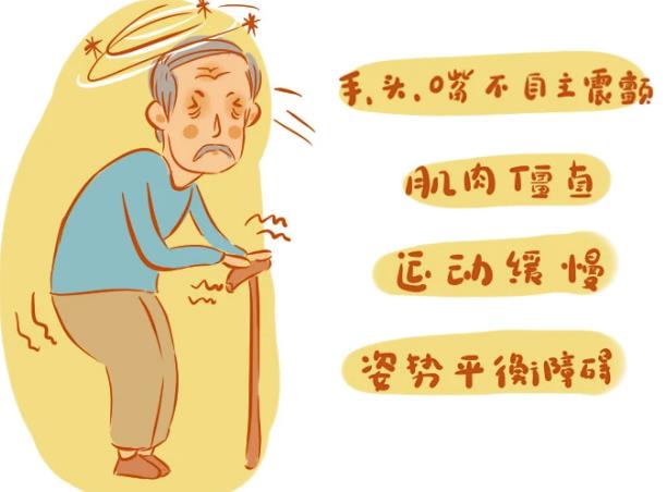 帕金森手術后會復發(fā)嗎 帕金森怎么治療